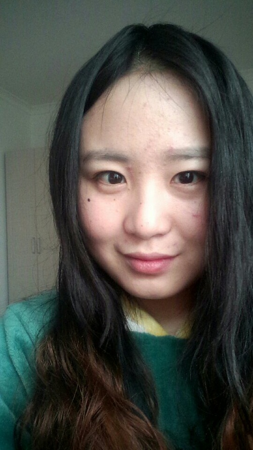 脸上长了痘痘又怎样，照样可以玩的狂拽酷炫……屌_来自扑克卷发的自拍私房照分享
