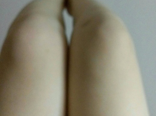 [晒]膝盖丑，怎么救？_来自花房姑娘的自拍私房照分享