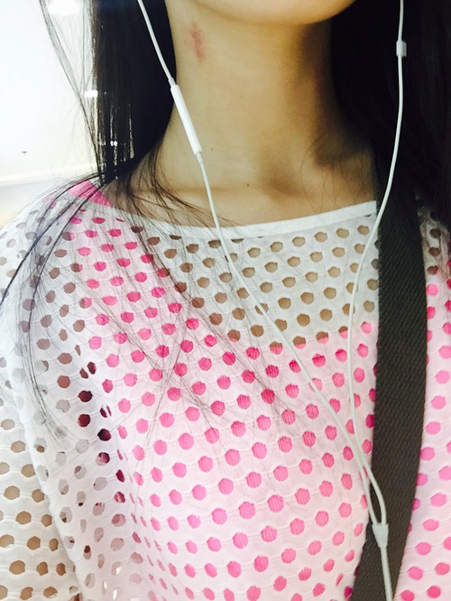一大早要去体检 肚子饿饿 不能吃东西(图2)_来自___ForxK的自拍私房照分享